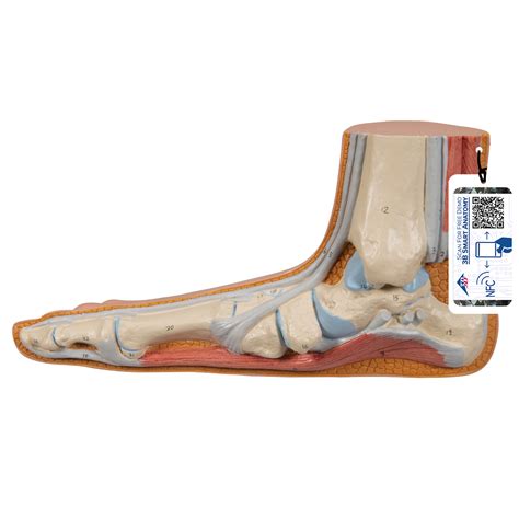 Hollow Foot (Pes Cavus) Model - 3B Smart Anatomy - SEM Trainers