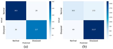 Deep Model Based on Mamba Fusion Multi-Scale Convolution LSTM for OSA ...