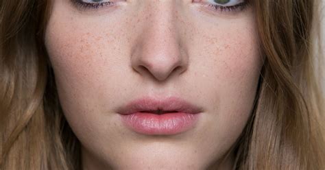 Image result for Zit Explosion