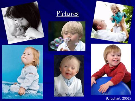 Down syndrome Power Poiny (Biology) | PPTX