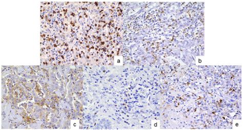 Cancers | Special Issue : The Pathology of Biliary Tract Carcinoma (BTC)