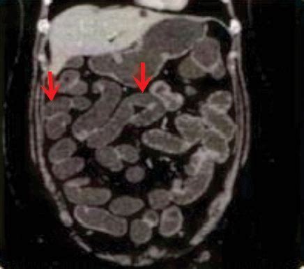 Contrast Media - GASTROSCAN-M 30