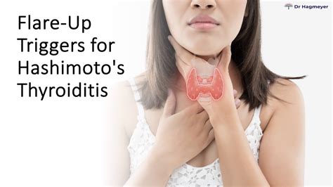 Managing Hashimoto's Thyroiditis: Identifying Triggers That Flare Up Your Symptoms | Dr. Hagmeyer