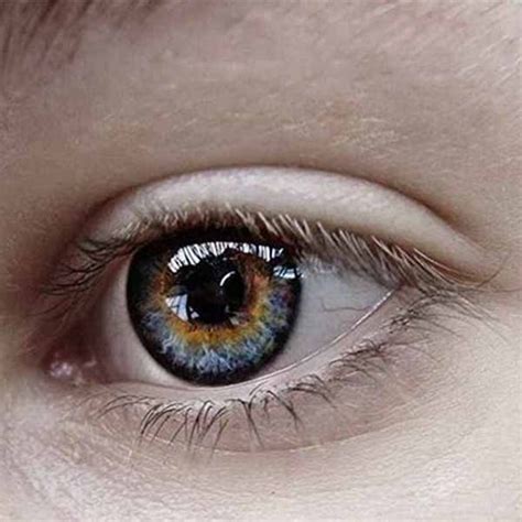 रतौंधी (Night Blindness) क्या है: लक्षण, कारण, और इलाज | Ratondhi Ka ...
