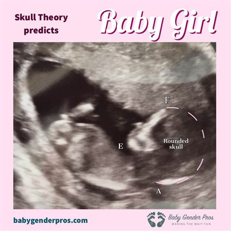 What Is The Skull Theory For Gender at Kate Hughes blog