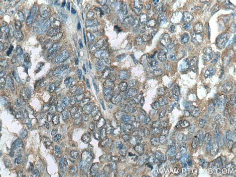 C11orf67 antibody (20414-1-AP) | Proteintech