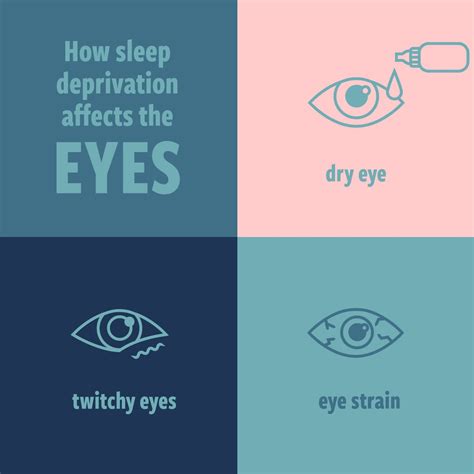 Pin on optometry ideas