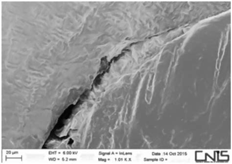Comparison of Two Root Canal Filling Techniques: Obturation with ...