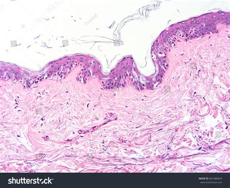 Human Epidermis Histology
