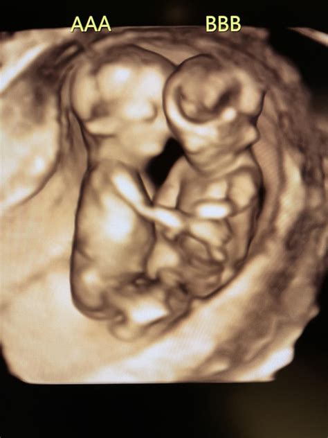 Our snuggly momo twins (12 weeks). I’m feeling really lucky to have ...