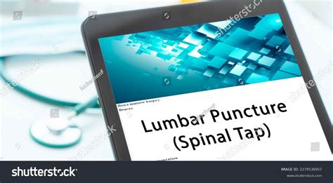 Image result for Spinal Tap Stumpy