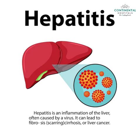 La hepatitis viral y su impacto global: Lo que debes saber