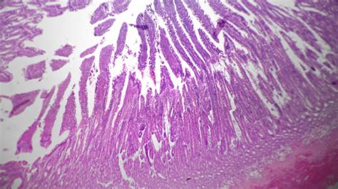 Image result for Jejunum Microscope