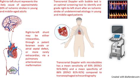 Transcranial Doppler With Microbubbles: Screening Test to Detect and Grade Right-to-Left Shunt ...