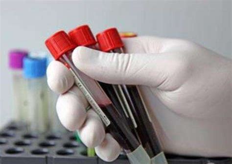 化验单怎么看血型-百度经验