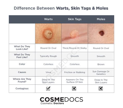 Genital Wart Vs Skin Tag