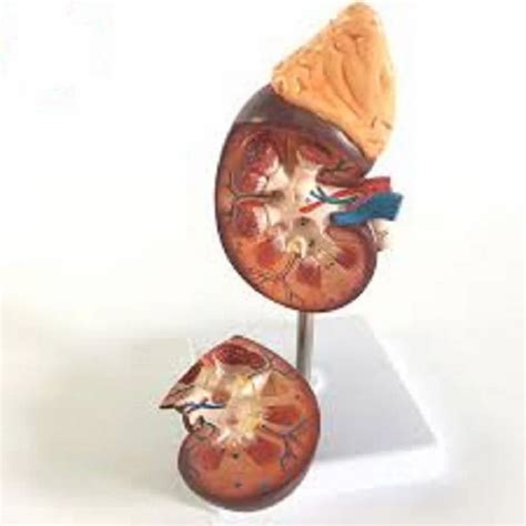 Anatomical Models - Magnified Pulmonary Alveolar Model Manufacturer ...