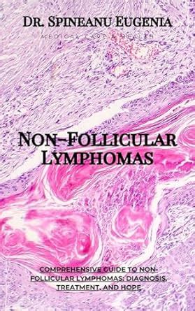 Comprehensive Guide to Non-Follicular Lymphomas: Diagnosis, Treatment ...
