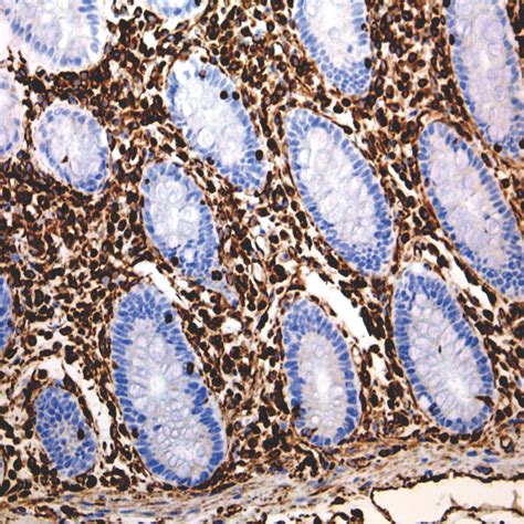 Vimentin-EP21 | PathnSitu Biotechnologies