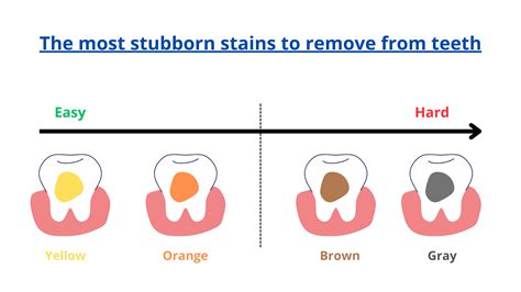 Image result for How to Remove Teeth Video