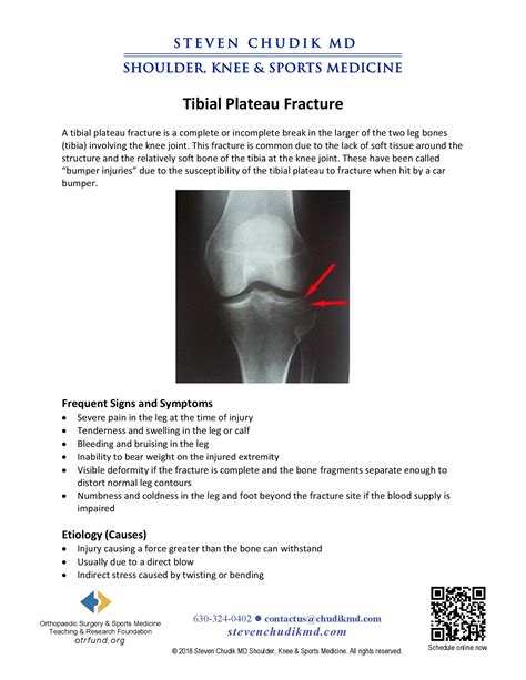 Tibial Plateau Fracture: Causes, Symptoms, And Treatment, 54% OFF