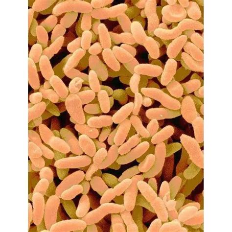 The Essential Acetobacter Species in Milk Kefir