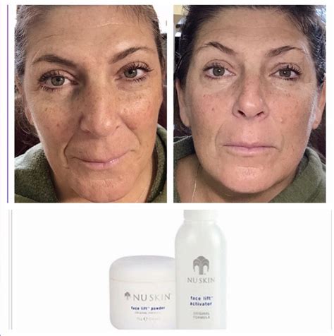 NuSkin Face Lift with Activator Nu skin Lift | Ubuy India