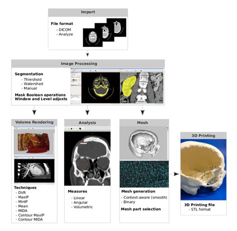 InVesalius Tutorial 的图像结果