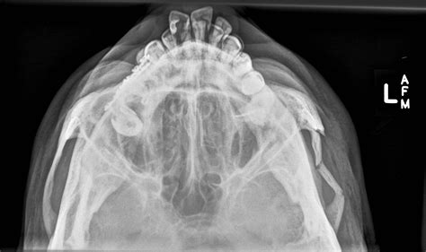 Zygomatic Arch Radiograph