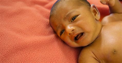 Image result for Neonatal Jaundice Algorithm