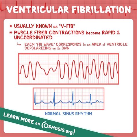 Image result for Fib Channel Trading View