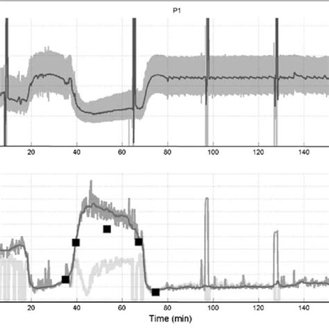 Image result for Pulse Pressure Variation Explained