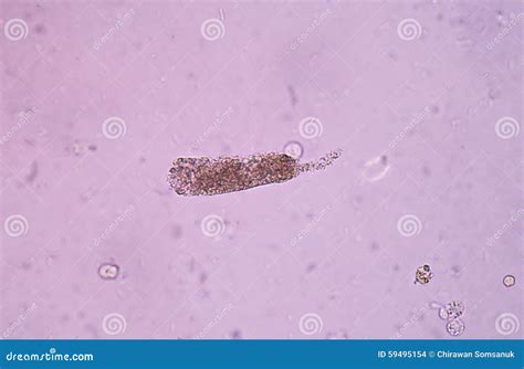 Urinary Casts Fine Granular Cast. Stock Photo - Image of hydrochloric ...