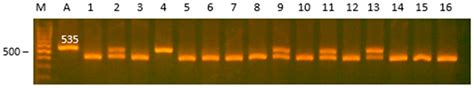 Search for Associations of FSHR, INHA, INHAB, PRL, TNP2 and SPEF2 Genes ...