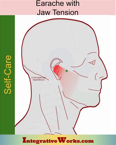 Trigger Points - Earache and Jaw tension | Integrative Works | Jaw pain relief, Trigger points ...
