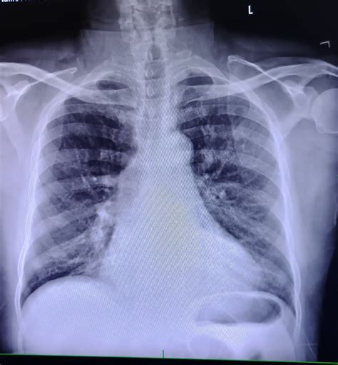 Patient Detail