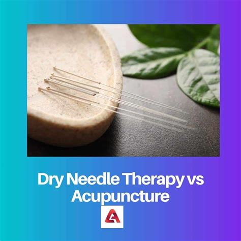 Dry Needling vs Acupuncture: Difference and Comparison