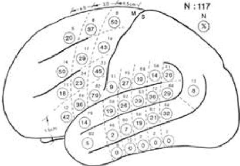 Image result for Language Mapping Scan