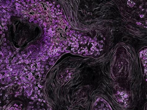 Sotorasib is First KRAS Inhibitor Approved by FDA - NCI