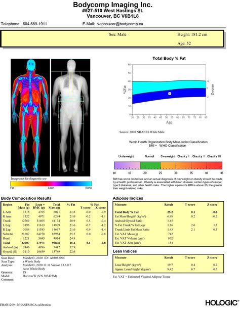 Sample Scans | Bone Density Test | Body Scan | Dexa