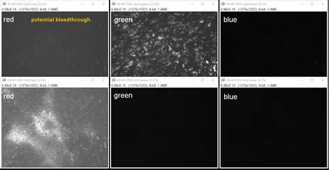 Image result for ImageJ Colocalization Coloc