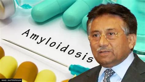 অ্যামাইলয়েডোসিসে ভুগে মৃত্যু হয়েছে পাক প্রেসিডেন্ট মোশারফের, কী এই রোগ