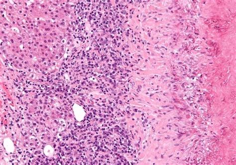 Mitra Diagnostic | Place for Blood Sugar Test in Chakdaha