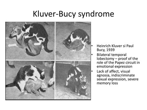 PPT - Parietal and Temporal Lobe Syndromes PowerPoint Presentation ...