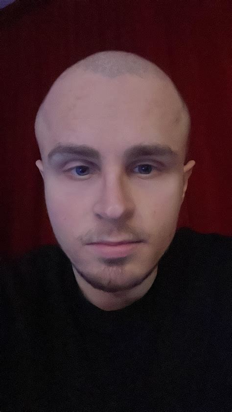 Weird head shape? 😅 : r/bald