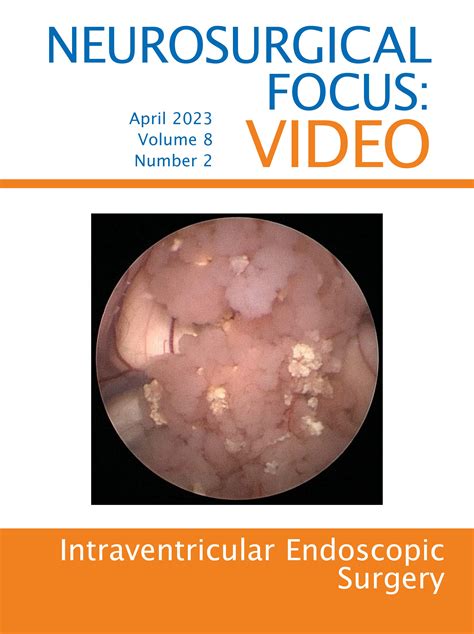 Endoscopic fenestration of an enlarging giant occipital arachnoid cyst in: Neurosurgical Focus ...