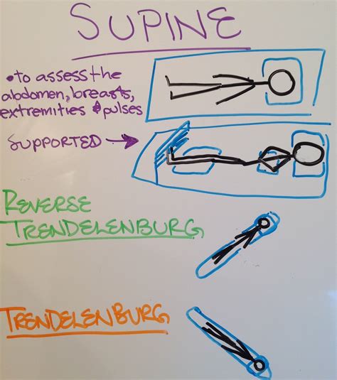Patient positioning - Supine, Reverse Trendelenburg, and Trendelenburg | Nurse study notes ...