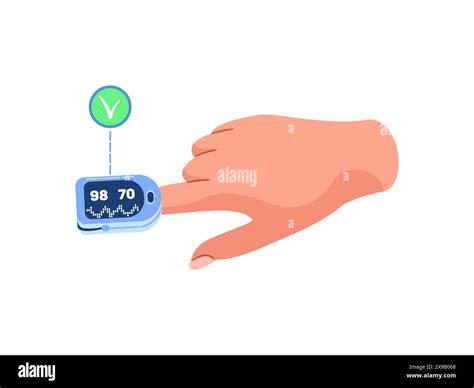 The electronic support measure Stock Vector Images - Alamy