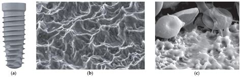 Developments in Dental Implant Surface Modification