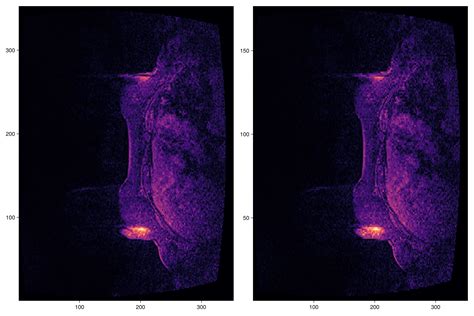 Image result for Genetic Algorithm Image Segmentation MATLAB